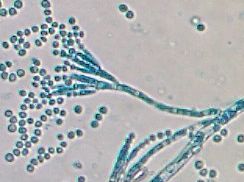 vue au microscope de penicillium roqueforti